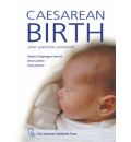 C Section Birth